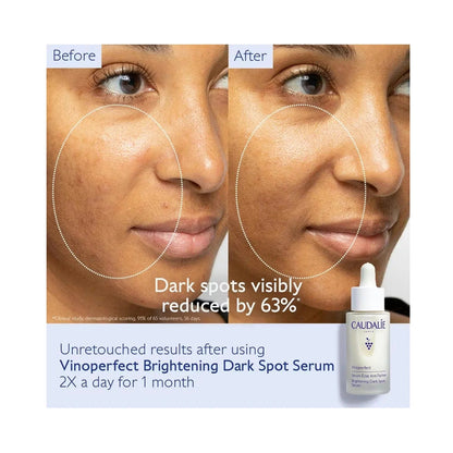 Caudalie Vinoperfect Brightening Dark Spot Serum – Radiance & Even Skin Tone